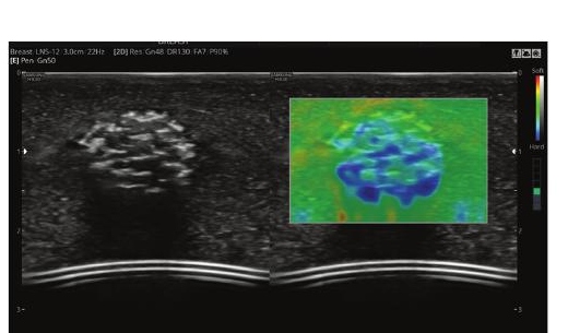 ElastoScan