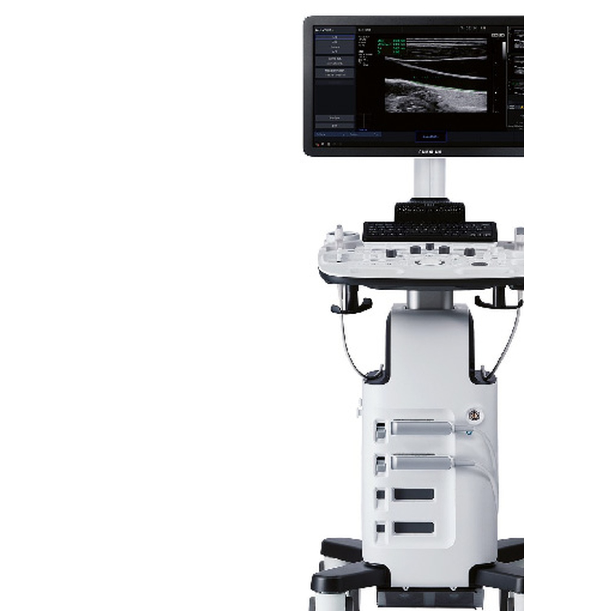 Samsung HS50 Ultrasound