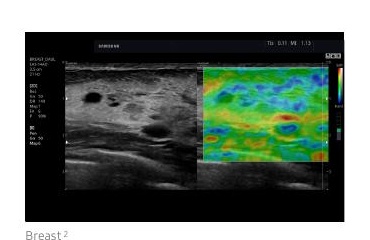 ElastoScan