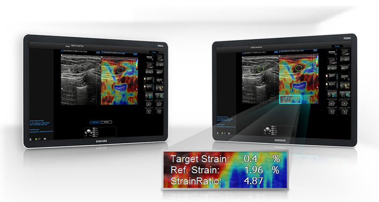 ElastoScan+
